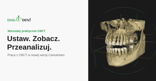 Warsztaty CBCT: Ustaw. Zobacz. Przeanalizuj. - praca w nowej wersji Carestream